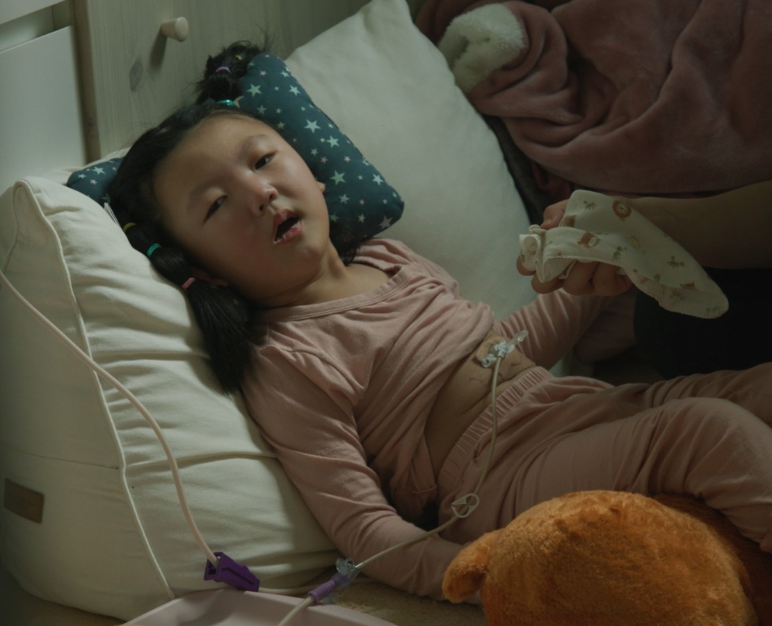 위루관으로 밥을 먹는 해나